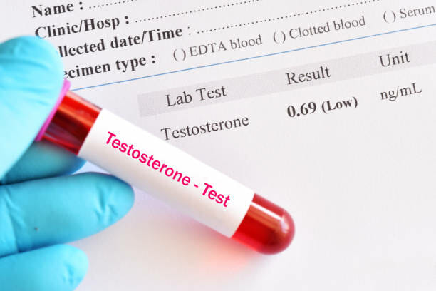 testosterone test