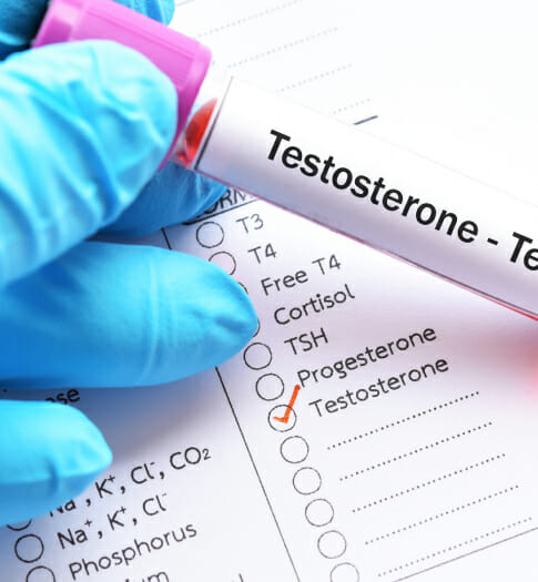 testosterone test